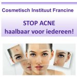 acne foto